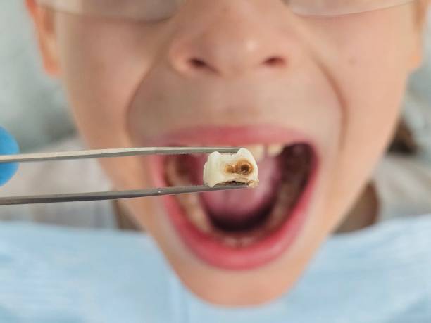 Emergency Dentist for Kids in NJ